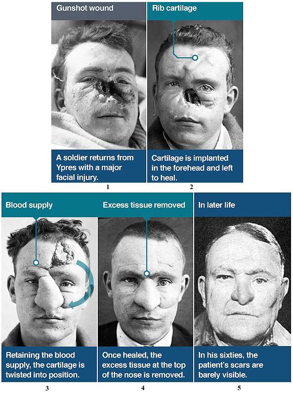 Disfigurement 2